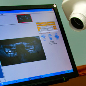 panoramic x-ray showing bone mass surrounding the teeth