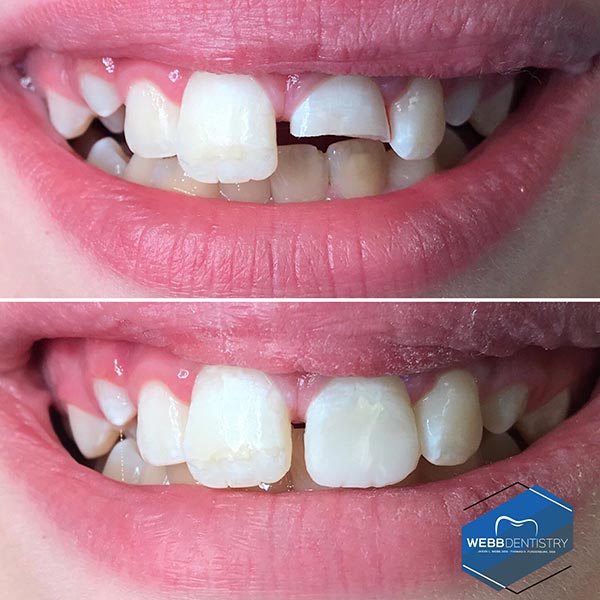b Dentistry Before & After Photos