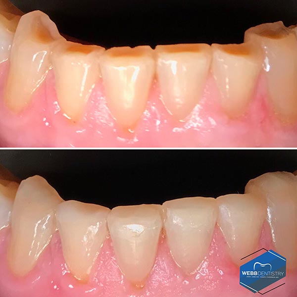 b Dentistry Before & After Photos