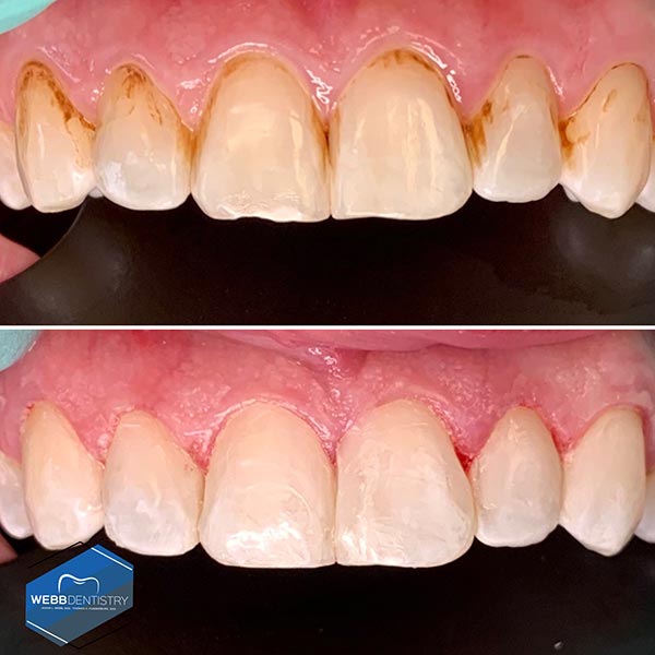 b Dentistry Before & After Photos